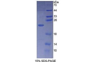 SDS-PAGE (SDS) image for phospholipase C, beta 1 (phosphoinositide-Specific) (PLCB1) (AA 316-476) protein (His tag) (ABIN4988764)