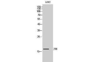 Western Blotting (WB) image for anti-Jumping Translocation Breakpoint (JTB) (N-Term) antibody (ABIN3180706) (JTB antibody  (N-Term))