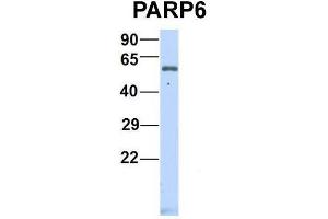 Host:  Rabbit  Target Name:  P Sample Type:  Human Fetal Heart  Antibody Dilution:  1. (PARP6 antibody  (N-Term))