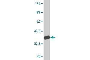 Western Blot detection against Immunogen (37. (EP400 antibody  (AA 743-850))