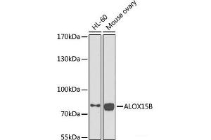Western blot analysis of extracts of various cell lines using ALOX15B Polyclonal Antibody at dilution of 1:1000. (ALOX15B antibody)