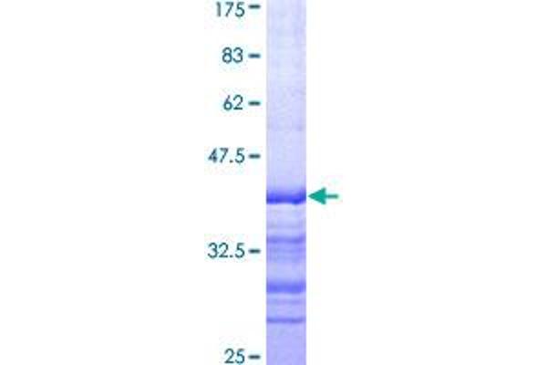 ARHGEF11 Protein (AA 651-750) (GST tag)