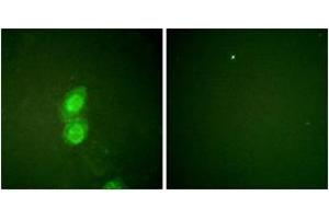 Immunofluorescence analysis of HuvEc cells, using Catenin-delta1 (Phospho-Tyr228) Antibody. (CTNND1 antibody  (pTyr228))