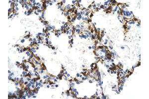 Rabbit Anti-NMI antibody        Paraffin Embedded Tissue:  Human Lung cell   Cellular Data:  Epithelial cells of renal tubule  Antibody Concentration:   4. (NMI antibody  (Middle Region))