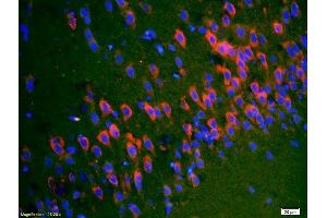 Formalin-fixed and paraffin-embedded rat brain labeled with Anti-SYTL5/slp5 Polyclonal Antibody, Unconjugated (ABIN754498) 1:200, overnight at 4°C, The secondary antibody was Goat Anti-Rabbit IgG, Cy3 conjugated used at 1:200 dilution for 40 minutes at 37°C. (SYTL5 antibody  (AA 801-921))