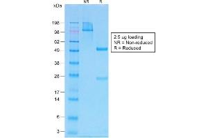SDS-PAGE Analysis Purified PTH Rabbit Recombinant Monoclonal Antibody (PTH/1717R). (Recombinant PTH antibody  (AA 1-34))