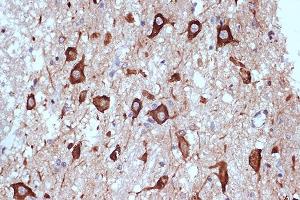 Immunohistochemistry of paraffin-embedded human brain using PRKRA/PACTRabbit mAb (ABIN7269666) at dilution of 1:100 (40x lens). (PRKRA antibody)