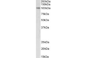 Western Blotting (WB) image for anti-Ubiquitin-Like, Containing PHD and RING Finger Domains, 1 (UHRF1) (C-Term) antibody (ABIN5539760)
