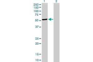 Western Blot analysis of DCTN2 expression in transfected 293T cell line by DCTN2 MaxPab polyclonal antibody. (Dynamitin antibody  (AA 1-401))