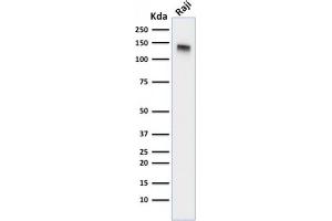 Western Blot Analysis of Raji cell lysate using CD22-Monospecific Mouse Monoclonal Antibody (BLCAM/1795). (CD22 antibody  (AA 52-178))