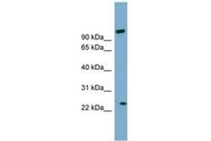 Image no. 1 for anti-ADP-Ribosylation Factor-Like 8A (ARL8A) (AA 71-120) antibody (ABIN6744124) (ARL8A antibody  (AA 71-120))