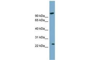 Image no. 1 for anti-ADP-Ribosylation Factor-Like 8A (ARL8A) (AA 71-120) antibody (ABIN6744124)