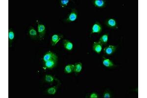 Immunofluorescence staining of A549 cells with ABIN7165570 at 1:133, counter-stained with DAPI. (FAM83G antibody  (AA 464-615))