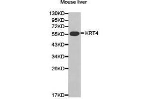 Western Blotting (WB) image for anti-Keratin 4 (KRT4) antibody (ABIN1873488) (KRT4 antibody)