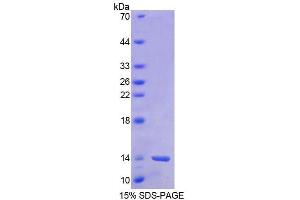 SDS-PAGE (SDS) image for Barrier To Autointegration Factor 1 (BANF1) (AA 2-89) protein (His tag) (ABIN6238749)