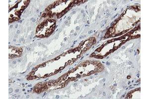 Immunohistochemical staining of paraffin-embedded Human Kidney tissue using anti-PFKP mouse monoclonal antibody. (PFKP antibody)