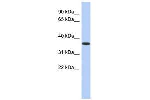 MVK antibody used at 1 ug/ml to detect target protein. (MVK antibody  (N-Term))