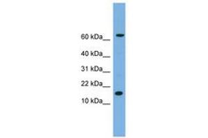 Image no. 1 for anti-Interleukin 1, beta (IL1B) (N-Term) antibody (ABIN6745054) (IL-1 beta antibody  (N-Term))