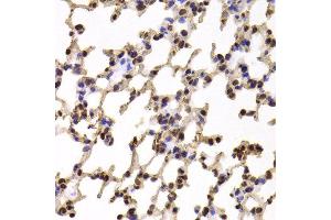 Immunohistochemistry of paraffin-embedded Mouse lung using KIF2B antibody at dilution of 1:100 (x400 lens). (KIF2B antibody)