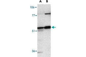 Western blot analysis of Casp12 in human (A) and mouse (B) spleen tissue lysates with Casp12 polyclonal antibody  at 1 ug/mL .