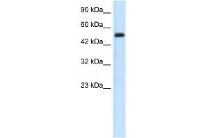 WB Suggested Anti-SMAD6 Antibody Titration:  0.