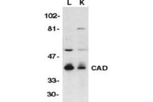 Image no. 1 for anti-DNA Fragmentation Factor, 40kDa, beta Polypeptide (Caspase-Activated DNase) (DFFB) (AA 314-329) antibody (ABIN201898)