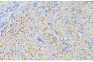 Immunohistochemistry of paraffin-embedded Rat ovary using ACADL Polyclonal Antibody at dilution of 1:100 (40x lens).