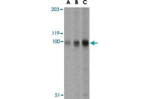 Western blot analysis of STIM2 in A-20 cell lysate with STIM2 polyclonal antibody  at (A) 0. (Stim2 antibody  (Internal Region))