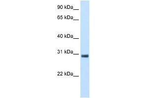 KCTD6 antibody  (N-Term)