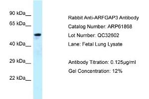 Western Blotting (WB) image for anti-ADP-Ribosylation Factor GTPase Activating Protein 3 (ARFGAP3) (C-Term) antibody (ABIN2788930) (ARFGAP3 antibody  (C-Term))