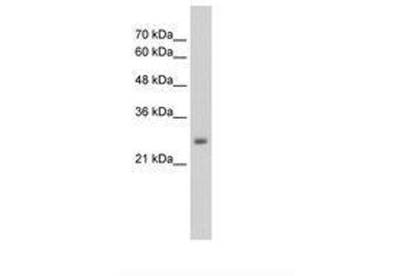 NMDA Receptor Synaptonuclear Signaling and Neuronal Migration Factor (NSMF) (AA 283-332) antibody