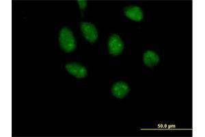 Immunofluorescence of purified MaxPab antibody to GATAD2B on HeLa cell. (GATAD2B antibody  (AA 1-593))