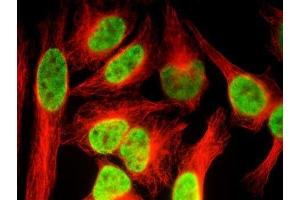 Histone H3K36me3 antibody (pAb) tested by immunofluorescence.