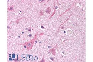 ABIN185467 (10µg/ml) staining of paraffin embedded Human Cortex. (SCN5A antibody  (Internal Region))