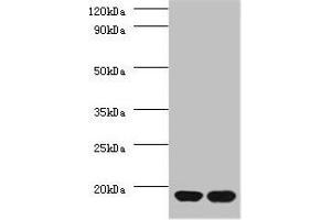 Western blot All lanes: RPS13 antibody at 2 μg/mL Lane 1: EC109 whole cell lysate Lane 2: 293T whole cell lysate Secondary Goat polyclonal to rabbit IgG at 1/15000 dilution Predicted band size: 18 kDa Observed band size: 18 kDa (RPS13 antibody  (AA 3-151))