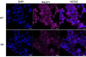 Immunocytochemical staining of HeLa cells using RALBP1 antibody (ABIN7800126), 1:1,000), Top panel: wild-type (WT), Bottom panal: RALBP1 shRNA knockdown (KD). (Recombinant RALBP1 antibody)