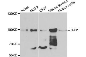 Western blot analysis of extracts of various cell lines, using TGS1 antibody. (TGS1 antibody)