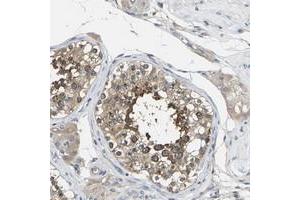 Immunohistochemical staining of human testis with TMCC2 polyclonal antibody  shows strong cytoplasmic positivity in cells in seminiferus ducts. (TMCC2 antibody)