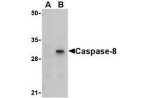 Western blot analysis of Caspase-8 in HT-29 cell lysate with AP30204PU-N Caspase-8 antibody (IN) at 1 μg/ml in (A) the presence or (B) the absence of blocking peptide. (Caspase 8 antibody)
