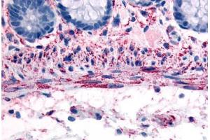 Human Smooth Muscle Cells (formalin-fixed, paraffin-embedded) stained with ADRA1B antibody ABIN213529 at 10 ug/ml followed by biotinylated goat anti-rabbit IgG secondary antibody ABIN481713, alkaline phosphatase-streptavidin and chromogen. (ADRA1B antibody  (C-Term))