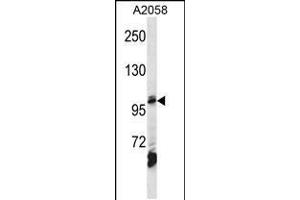 Western blot analysis in A2058 cell line lysates (35ug/lane). (AP2B1 antibody  (AA 517-546))