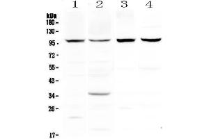 Western blot analysis of DYRK1A using anti-DYRK1A antibody . (DYRK1A antibody  (AA 38-269))