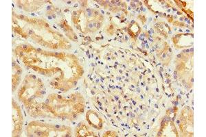 Immunohistochemistry of paraffin-embedded human kidney tissue using ABIN7153737 at dilution of 1:100 (TSTA3 antibody  (AA 1-314))