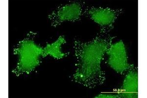 Immunofluorescence of monoclonal antibody to LSM3 on HeLa cell. (LSM3 antibody  (AA 1-102))