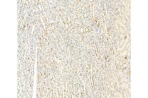 ABIN6260963 and ABIN6266517 at 1/100 staining Rat kidney tissue by IHC-P. (Connexin 43/GJA1 antibody  (Internal Region))