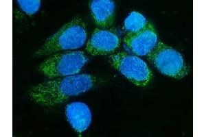 IF analysis of TIMM8A/DDP using anti-TIMM8A/DDP antibody (ABIN7600039).