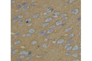 IHC-P analysis of Rat Tissue, with DAB staining. (KIF5B antibody  (AA 9-226))