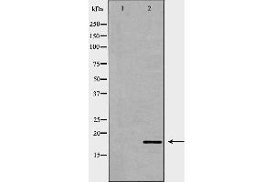 Western blot analysis of HepG2 cell lysate, using ISG15 Antibody. (ISG15 antibody  (C-Term))