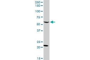 CAMKK2 MaxPab rabbit polyclonal antibody. (CAMKK2 antibody  (AA 1-541))