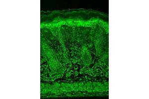 Immunohistochemistry analysis using Mouse Anti-HIF1 alpha Monoclonal Antibody, Clone ESEE122 . (HIF1A antibody  (AA 329-530) (FITC))